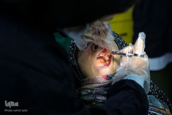 خدمات دندانپزشکی به مناطق محروم خراسان شمالی‎‎‎